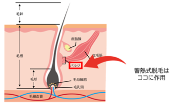 ヒゲ脱毛の施術イメージ